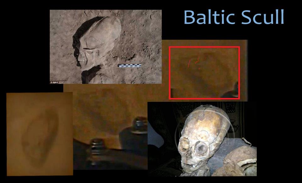 baltic-skull