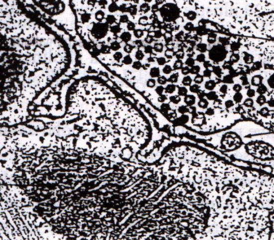 Synapm e